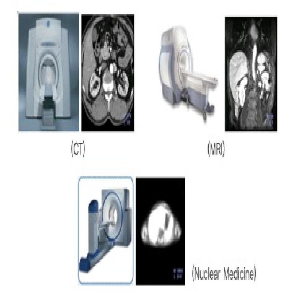 Medical Software : Vfusion
