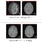 detail image2 Medical Software : Vfusion