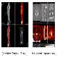 full image Medical Software : Vfusion