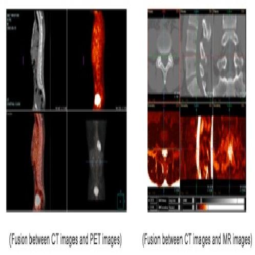 Medical Software : Vfusion